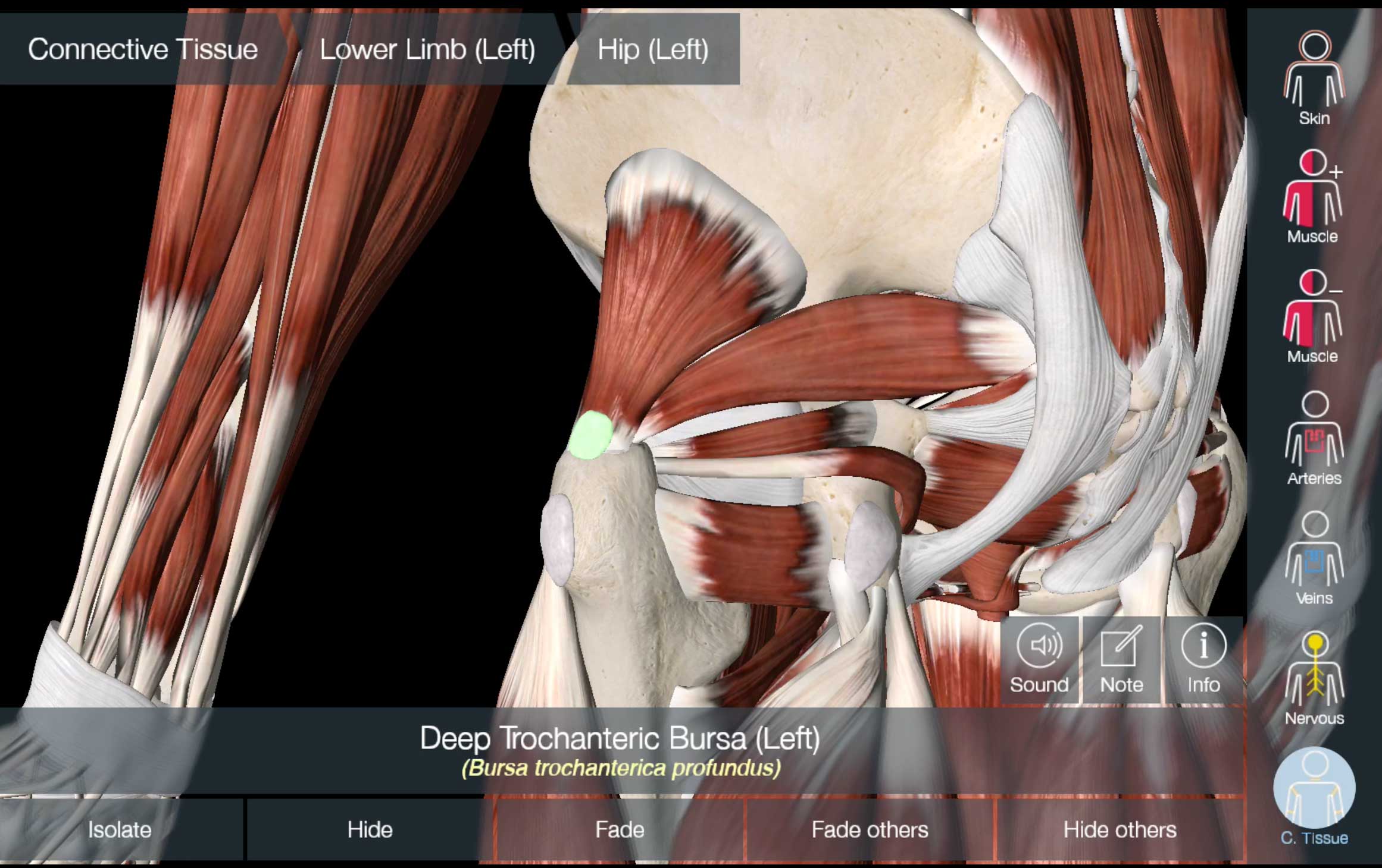 Sciatic nerve irritation hip bursitis